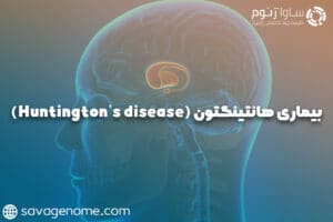 بیماری هانتینگتون (Huntington’s disease)