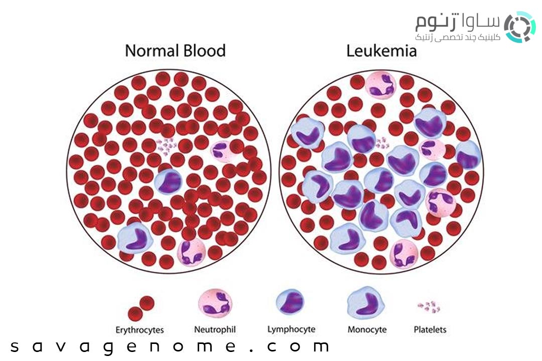 مقایسه خون معمولی و خون لوسمی