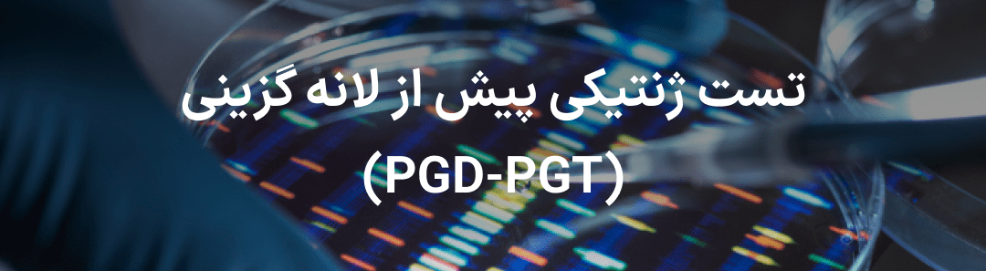 تست ژنتیکی پیش از لانه گزینی (PGD-PGT)